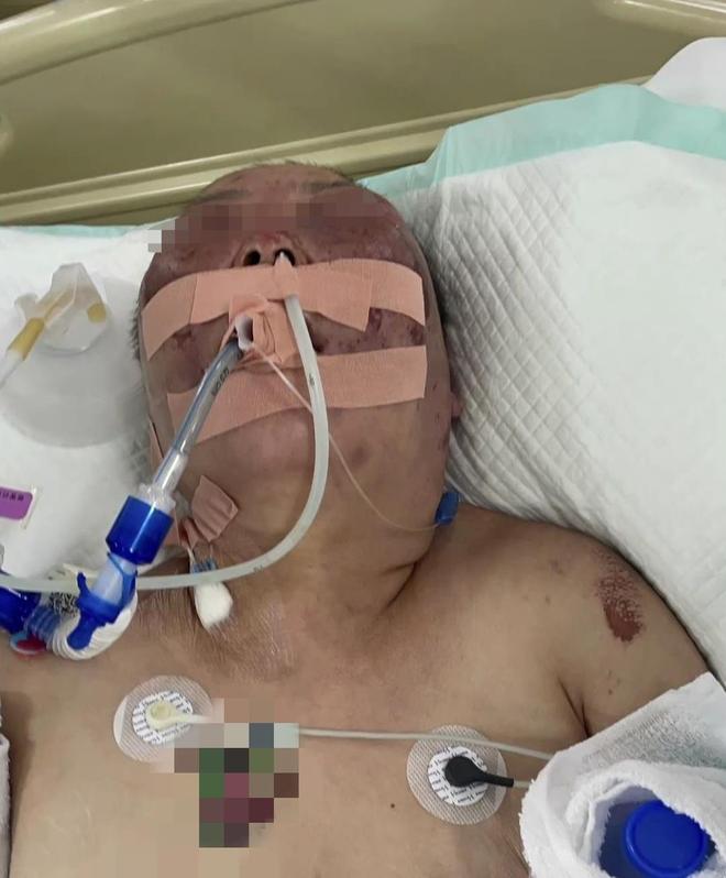 現金網：警方通報“男子毆打前妻致其腸破裂住進ICU”：受害人已死亡，嫌犯已被逮捕